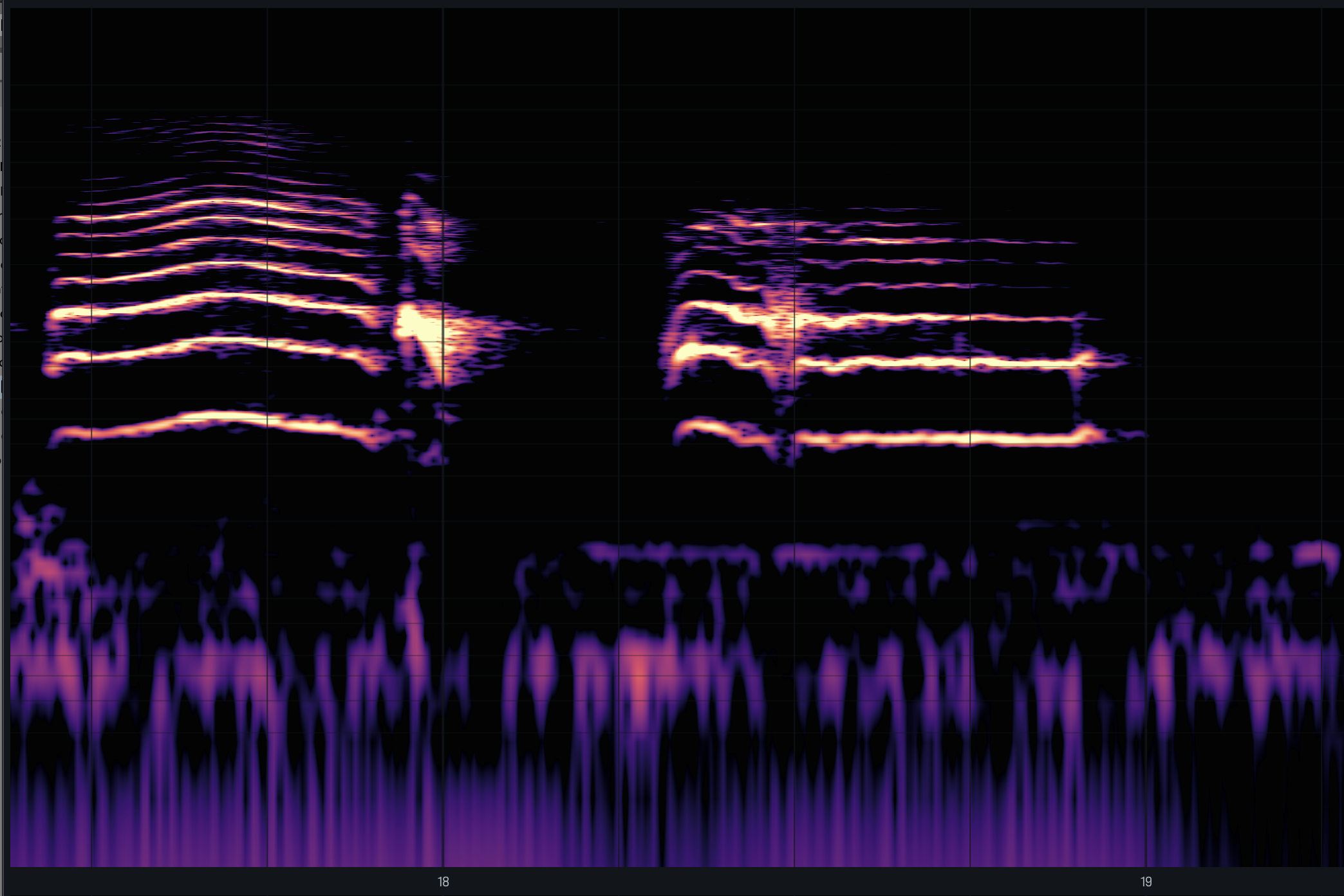 spectrogram d'un nouveau né